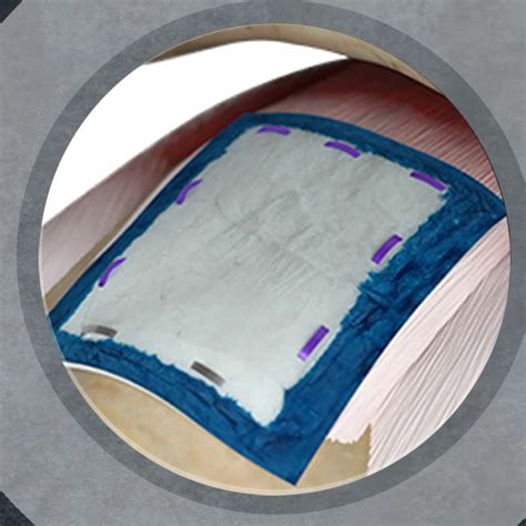 patch saddle nephew|Orthopaedics .